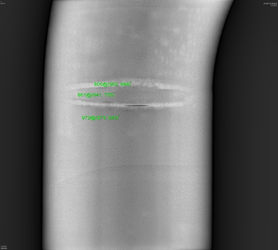 ポータブルX線発生装置 IXSシリーズ｜非破壊検査や超音波探傷器